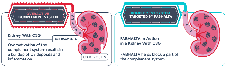 Image of kidney with C3G and FABHALTA in action in a kidney with C3G