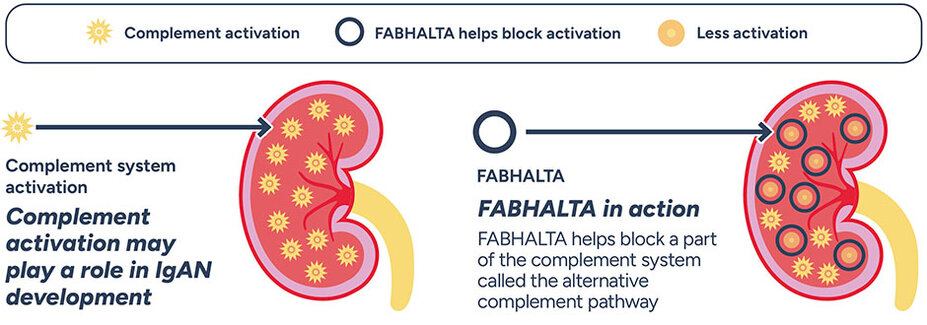 Complement activation may play a role in IgAN development. FABHALTA helps block a part of the immune system called the alternative complement pathway.